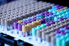 Voiko banaanin kuitu auttaa alentamaan kolesterolia? Banaanin sisältämä kuitu ja sen vaikutukset LDL-kolesterolin Alentamiseen