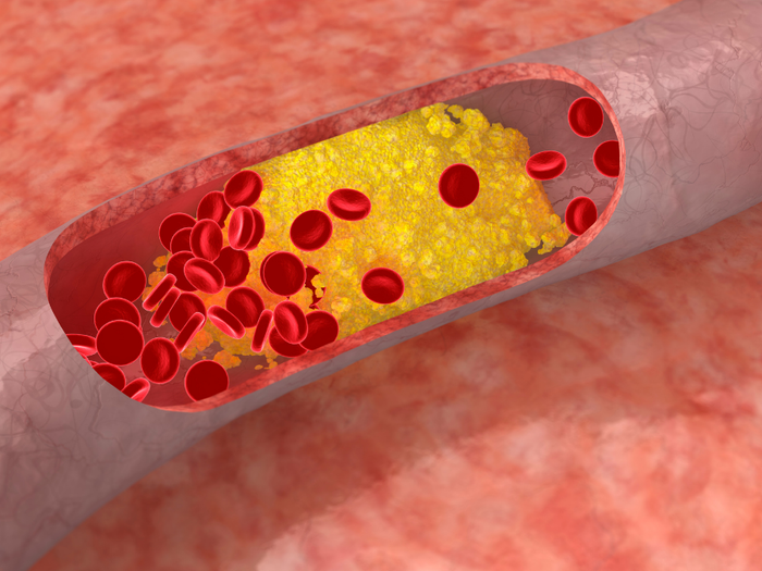 Onko kananmunien syöminen ok kolesterolin kannalta?