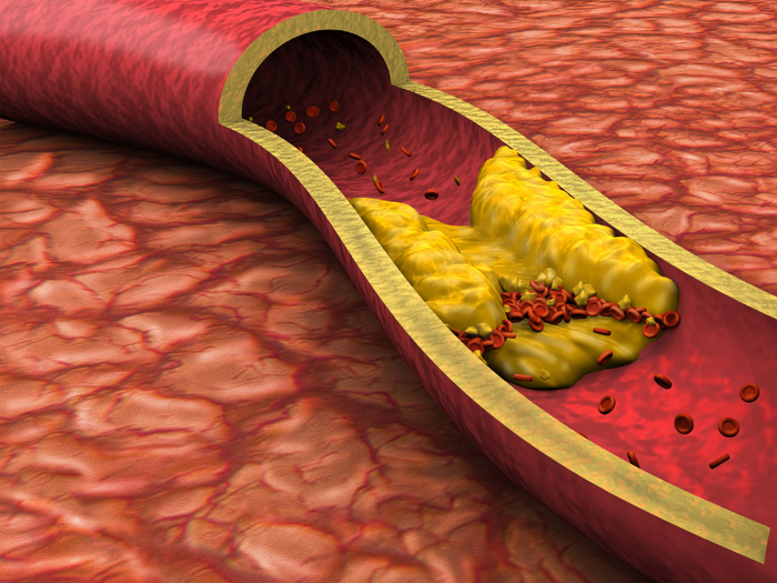 Kaikki kasviöljyt vertailussa